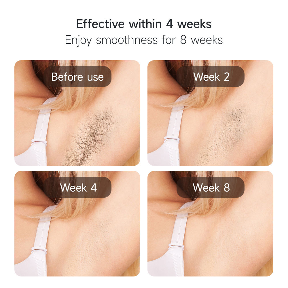 IPL Pro Max — detailed view